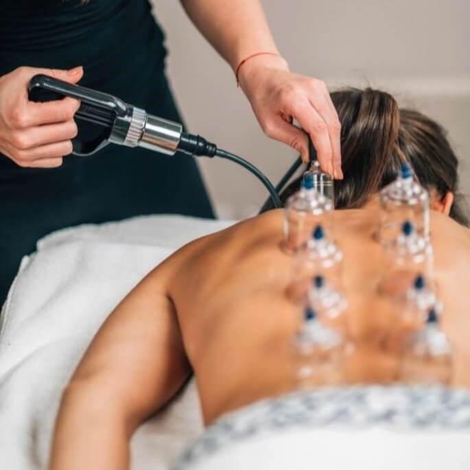 Cupping Procedure